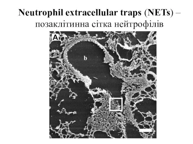Neutrophil extracellular traps (NETs) – позаклітинна сітка нейтрофілів