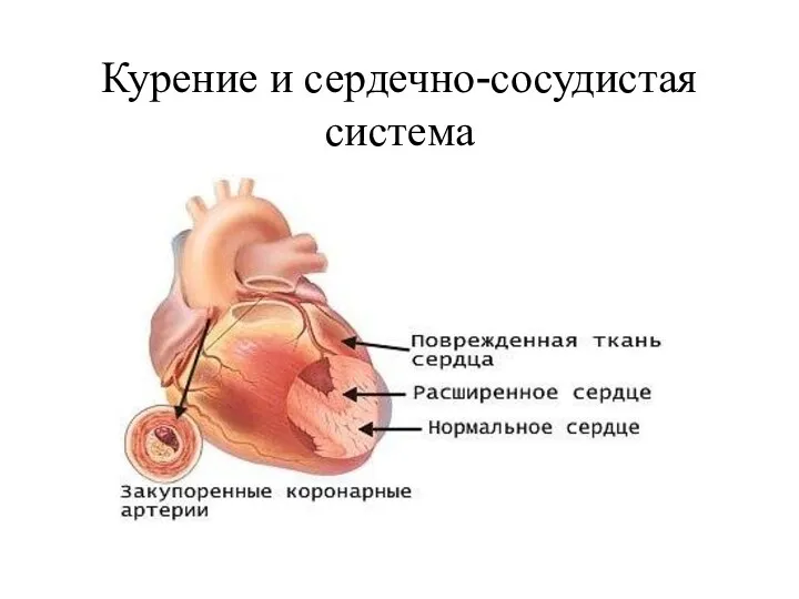 Курение и сердечно-сосудистая система