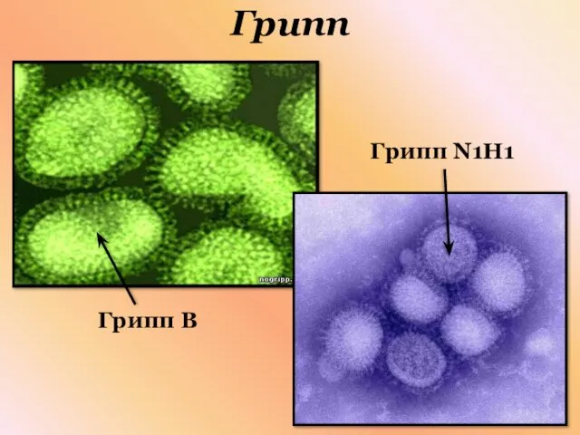 Грипп Грипп В Грипп N1H1