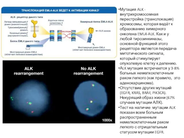 Мутация ALK - внутрихромосомная перестройка (транслокация) хромосомы, которая ведёт к образованию химерного онкогена