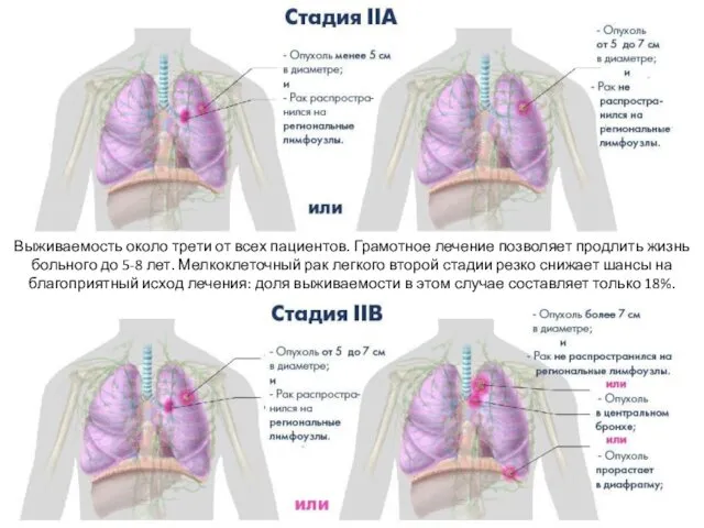 Выживаемость около трети от всех пациентов. Грамотное лечение позволяет продлить жизнь больного до