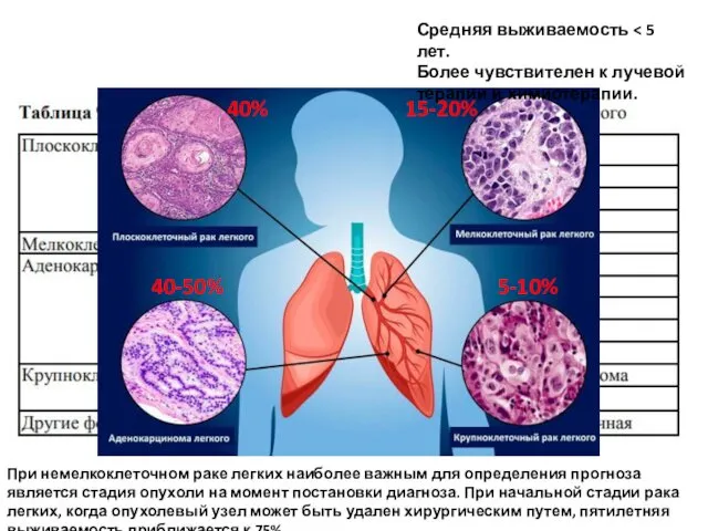 40% 40-50% 15-20% 5-10% Средняя выживаемость Более чувствителен к лучевой