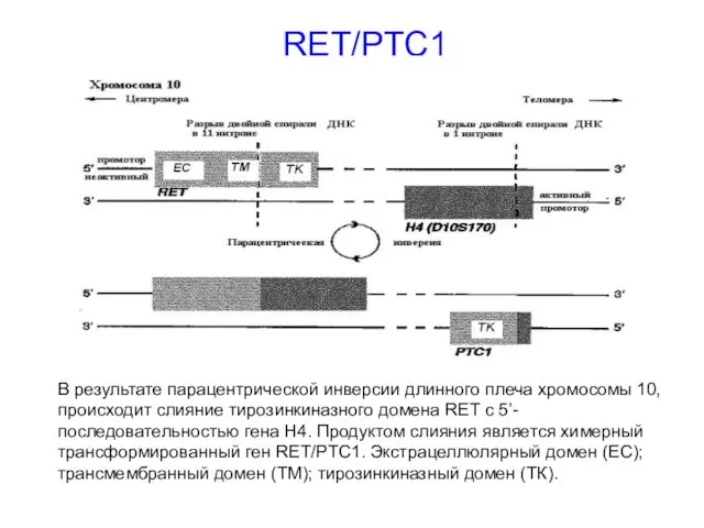 RET/PTC1 В результате парацентрической инверсии длинного плеча хромосомы 10, происходит