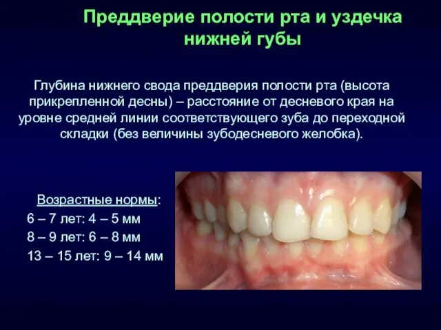 Преддверие полости рта и уздечка нижней губы Глубина нижнего свода