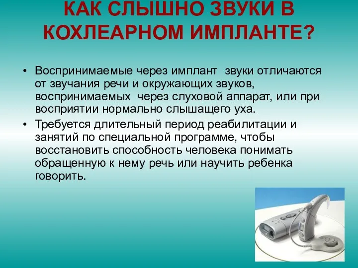 КАК СЛЫШНО ЗВУКИ В КОХЛЕАРНОМ ИМПЛАНТЕ? Воспринимаемые через имплант звуки