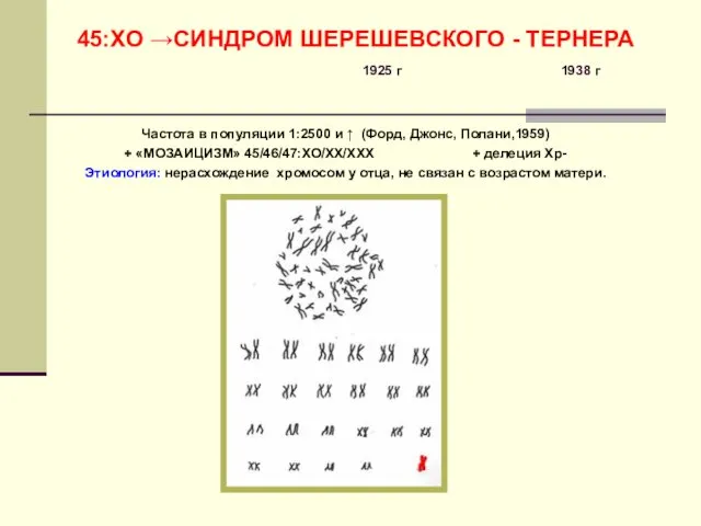 45:ХО →СИНДРОМ ШЕРЕШЕВСКОГО - ТЕРНЕРА 1925 г 1938 г Частота