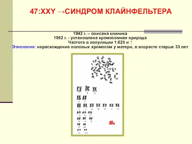 47:ХХY →СИНДРОМ КЛАЙНФЕЛЬТЕРА 1942 г. – описана клиника 1952 г.