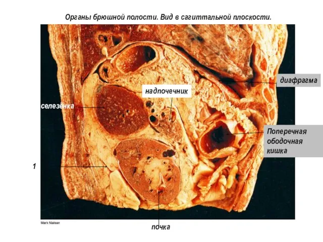 1 почка селезёнка диафрагма Поперечная ободочная кишка надпочечник Органы брюшной полости. Вид в сагиттальной плоскости.