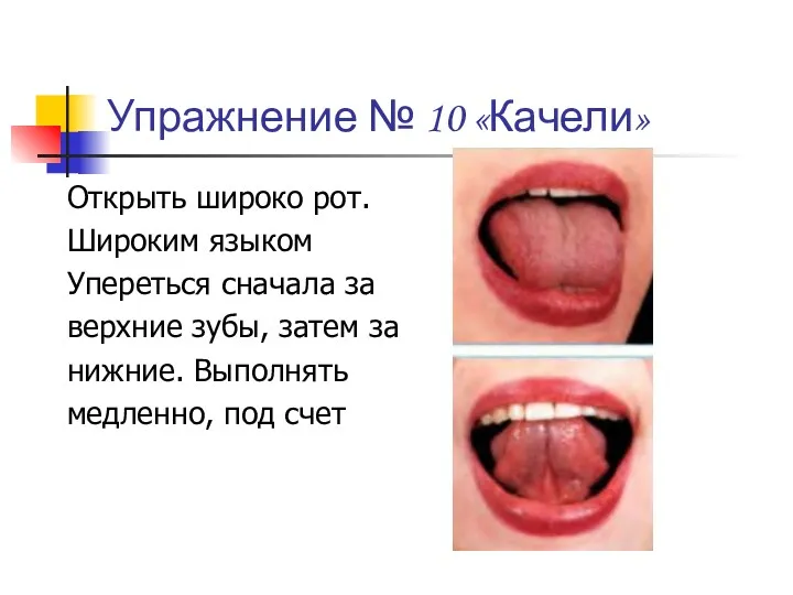 Упражнение № 10 «Качели» Открыть широко рот. Широким языком Упереться сначала за верхние