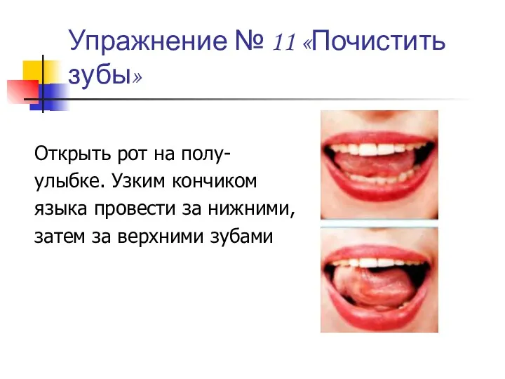 Упражнение № 11 «Почистить зубы» Открыть рот на полу- улыбке. Узким кончиком языка