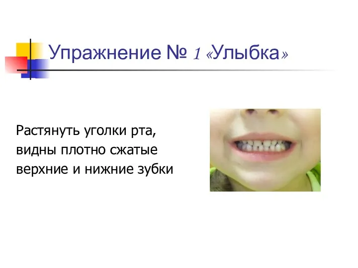 Упражнение № 1 «Улыбка» Растянуть уголки рта, видны плотно сжатые верхние и нижние зубки