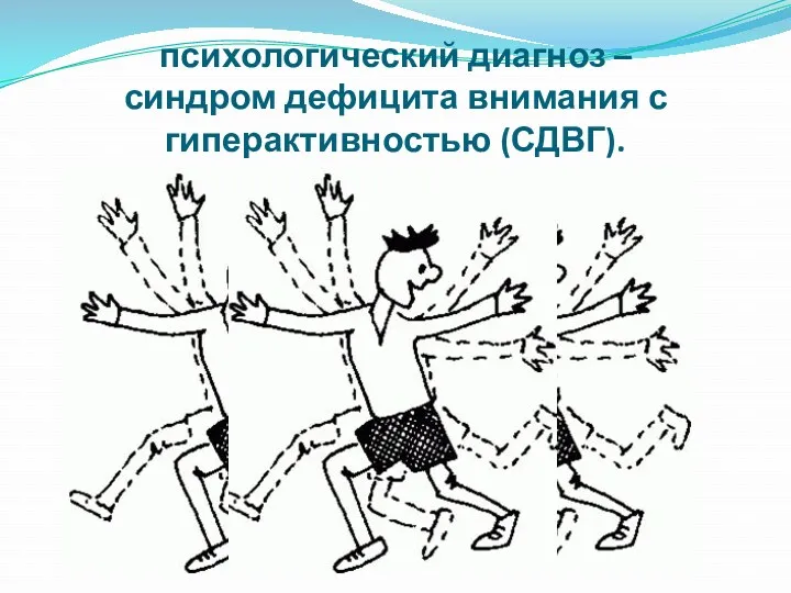 психологический диагноз – синдром дефицита внимания с гиперактивностью (СДВГ).