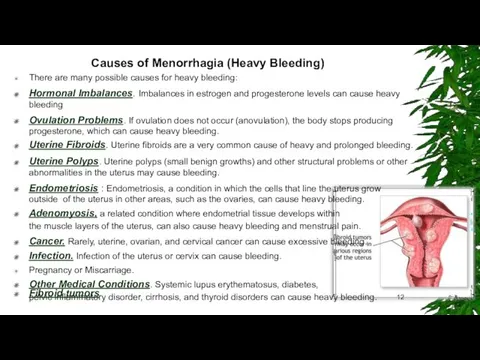 Causes of Menorrhagia (Heavy Bleeding) There are many possible causes