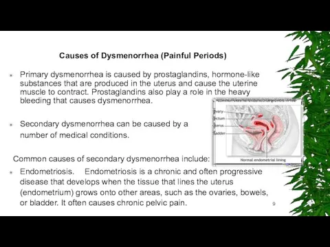 Causes of Dysmenorrhea (Painful Periods) Primary dysmenorrhea is caused by