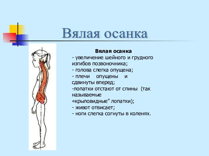 Вялая осанка - увеличение шейного и грудного изгибов позвоночника; -