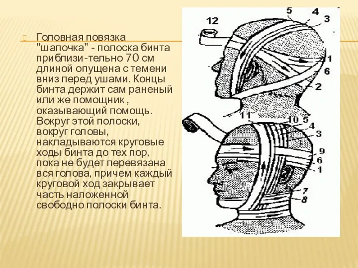 Головная повязка "шапочка" - полоска бинта приблизи-тельно 70 см длиной