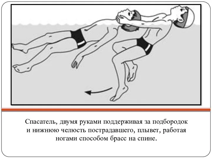 Спасатель, двумя руками поддерживая за подбородок и нижнюю челюсть пострадавшего,