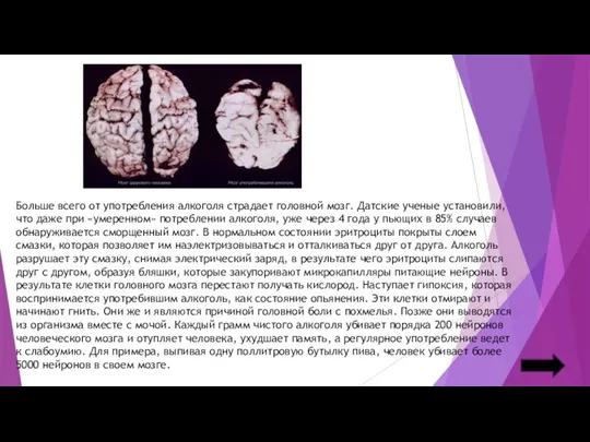 Больше всего от употребления алкоголя страдает головной мозг. Датские ученые