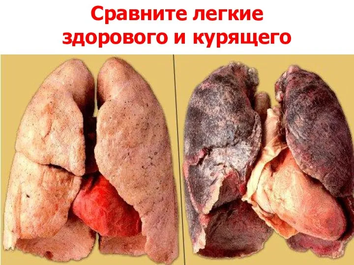 Сравните легкие здорового и курящего
