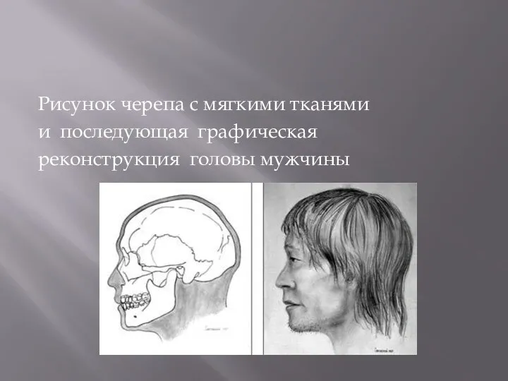 Рисунок черепа с мягкими тканями и последующая графическая реконструкция головы мужчины