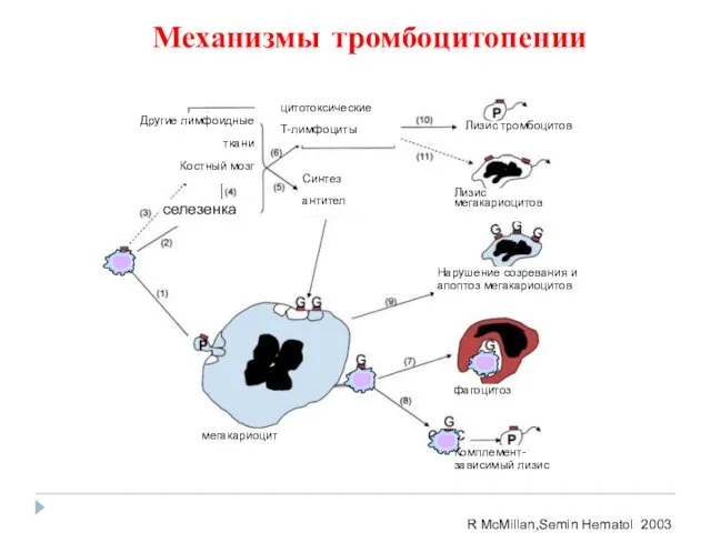 Механизмы тромбоцитопении R McMillan,Semin Hematol 2003