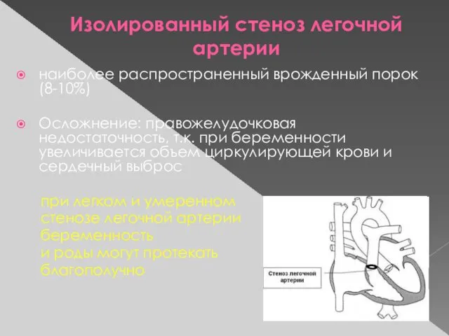 Изолированный стеноз легочной артерии наиболее распространенный врожденный порок (8-10%) Осложнение: