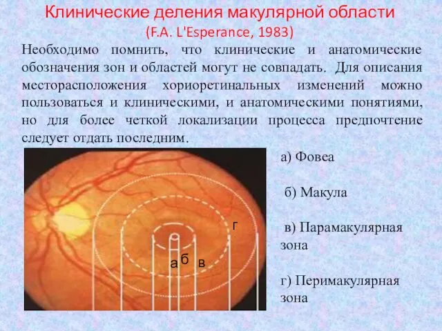 Клинические деления макулярной области (F.A. L'Esperance, 1983) Необходимо помнить, что