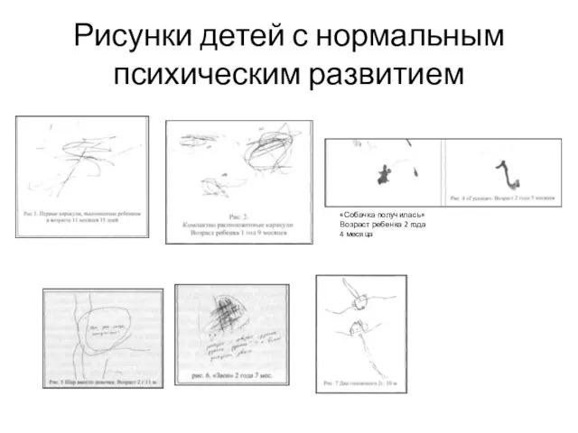 Рисунки детей с нормальным психическим развитием «Собачка получилась» Возраст ребенка 2 года 4 месяца