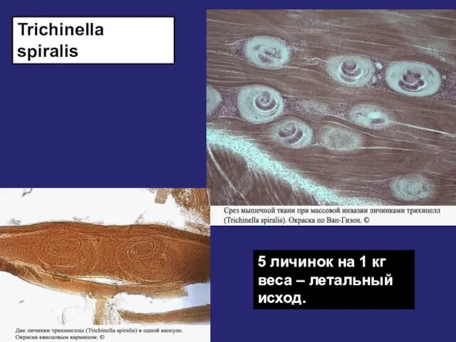Trichinella spiralis 5 личинок на 1 кг веса – летальный исход.