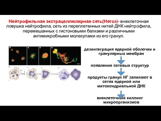 Нейтрофильная экстрацеллюлярная сеть(Нетоз)- внеклеточная ловушка нейтрофила, сеть из переплетенных нитей ДНК нейтрофила, перемешанных