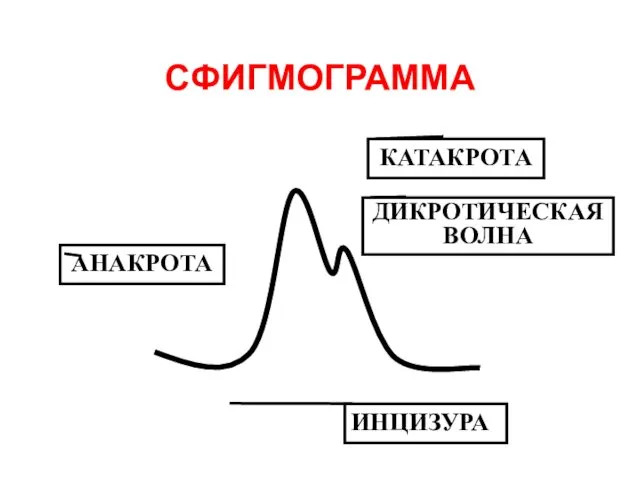 СФИГМОГРАММА АНАКРОТА КАТАКРОТА ДИКРОТИЧЕСКАЯ ВОЛНА ИНЦИЗУРА