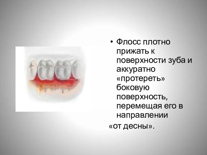 Флосс плотно прижать к поверхности зуба и аккуратно «протереть» боковую поверхность, перемещая его