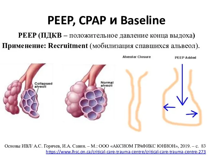 PEEP, CPAP и Baseline PEEP (ПДКВ – положительное давление конца выдоха) Применение: Recruitment