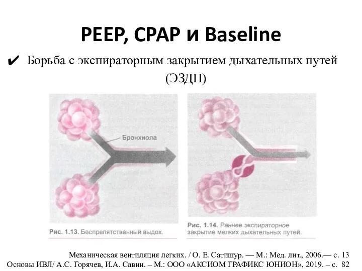 PEEP, CPAP и Baseline Борьба с экспираторным закрытием дыхательных путей (ЭЗДП) Механическая вентиляция