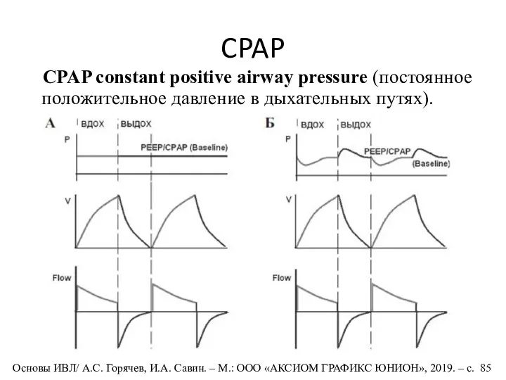 CPAP CPAP constant positive airway pressure (постоянное положительное давление в дыхательных путях). Основы