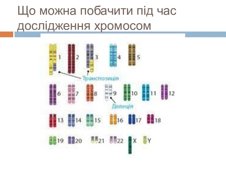 Що можна побачити під час дослідження хромосом