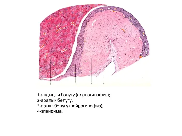 1-алдыңкы бөлүгү (аденогипофиз); 2-аралык бөлүгү; 3-арткы бөлүгү (нейрогипофиз); 4-эпендима.