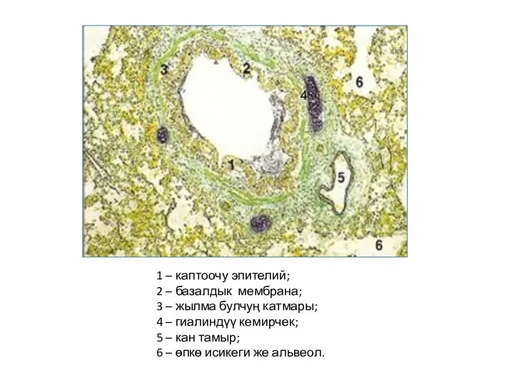 4 1 – каптоочу эпителий; 2 – базалдык мембрана; 3