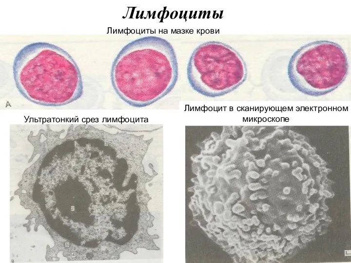 Лимфоциты Ультратонкий срез лимфоцита Лимфоцит в сканирующем электронном микроскопе Лимфоциты на мазке крови