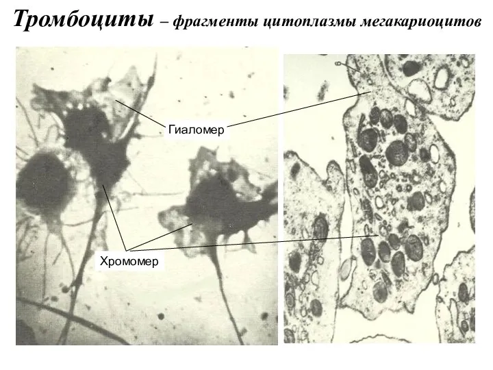 Тромбоциты – фрагменты цитоплазмы мегакариоцитов Гиаломер Хромомер