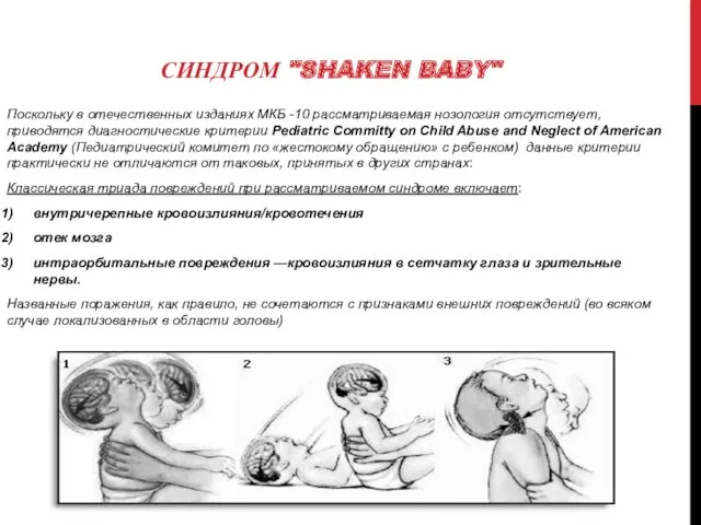 СИНДРОМ "SHAKEN BABY" Поскольку в отечественных изданиях МКБ -10 рассматриваемая