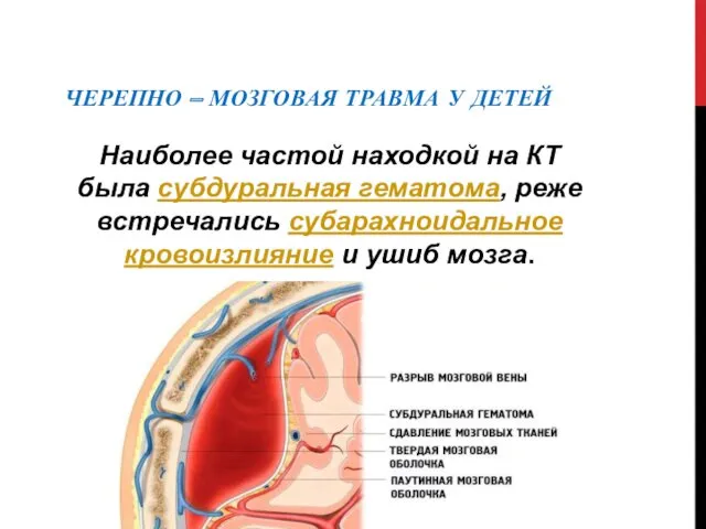 ЧЕРЕПНО – МОЗГОВАЯ ТРАВМА У ДЕТЕЙ Наиболее частой находкой на