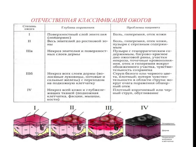 ОТЕЧЕСТВЕННАЯ КЛАССИФИКАЦИЯ ОЖОГОВ