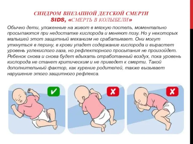 СИНДРОМ ВНЕЗАПНОЙ ДЕТСКОЙ СМЕРТИ SIDS, «СМЕРТЬ В КОЛЫБЕЛИ» Обычно дети,