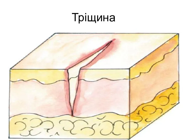 Тріщина