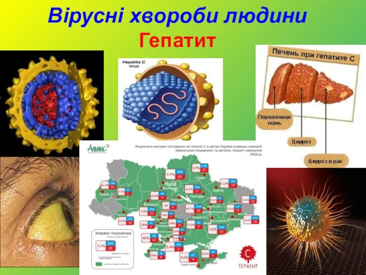 Вірусні хвороби людини Гепатит