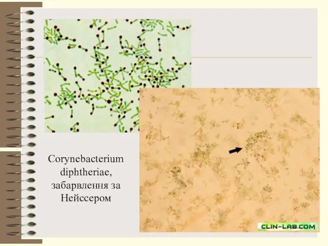 Corynebacterium diphtheriae, забарвлення за Нейссером