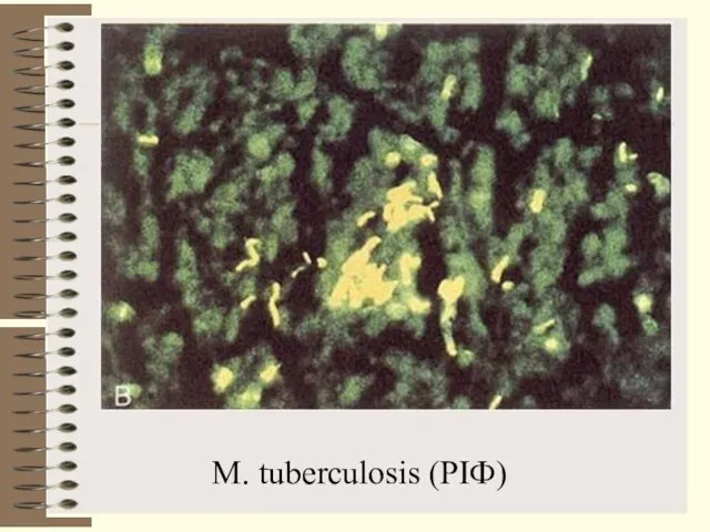 M. tuberculosis (РІФ)