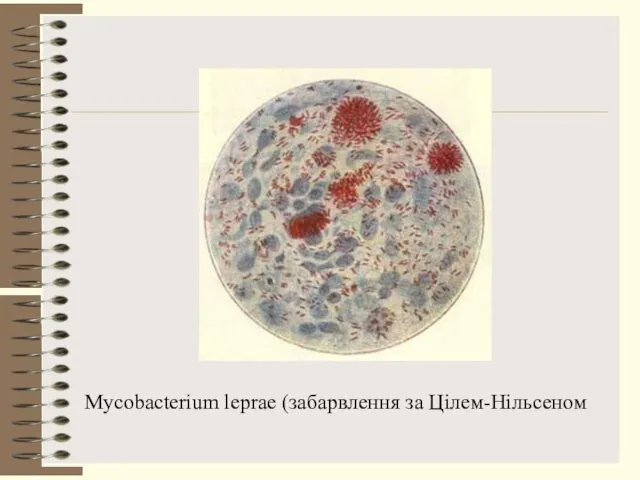 Mycobacterium leprae (забарвлення за Цілем-Нільсеном