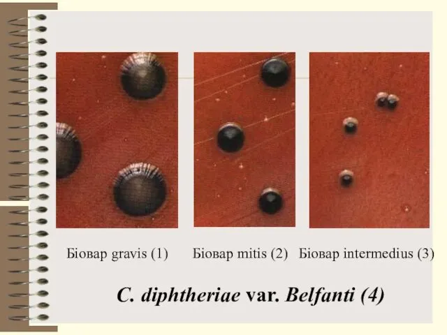 Біовар gravis (1) Біовар mitis (2) Біовар intermedius (3) С. diphtheriae var. Belfanti (4)